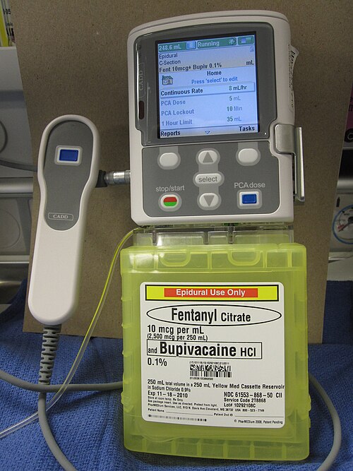 An infusion pump at a hospital bedside
